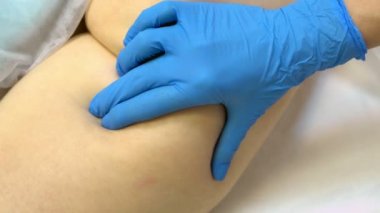 Selülit. Doktorlar el masaj kalça kadınlar