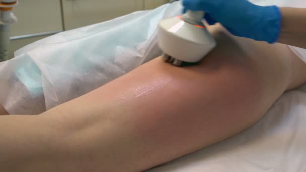 Skin rejuvenation procedure legs — Stock Video