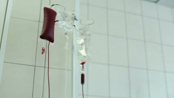 血漿交換を実施するための装置 — ストック動画