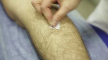 Akupunktur doktor iğne bacağından kurar.