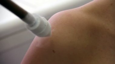 Kriyoterapi tıp Kliniği