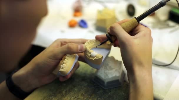 Trabajos de laboratorio dental — Vídeo de stock