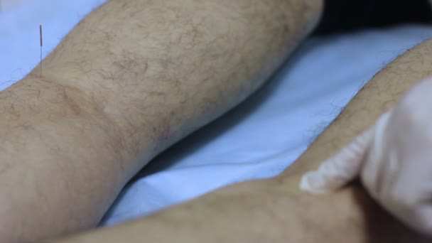 Ο γιατρός καθορίζει βελόνα στο ένα πόδι ασθενείς — Αρχείο Βίντεο