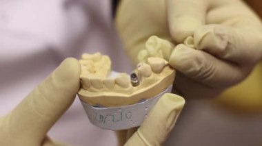 Implant örneği