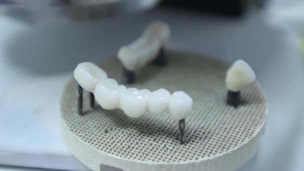 Dentiers, dents artificielles 