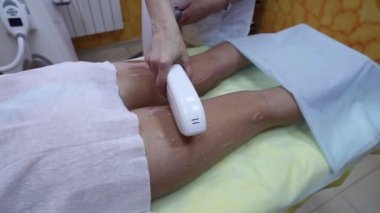 Bacak epilasyon lazer