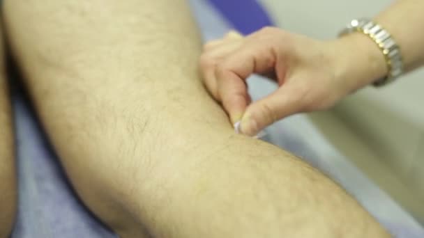 Installation medizinischer Nadel im Fuß des Patienten — Stockvideo