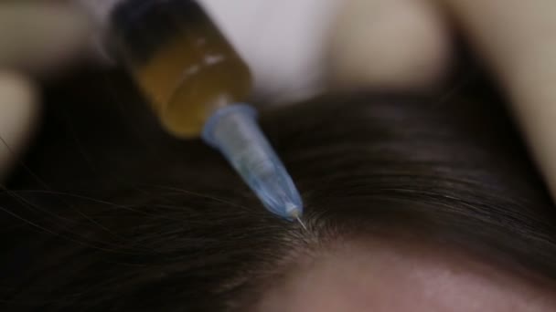 Лікування голови — стокове відео