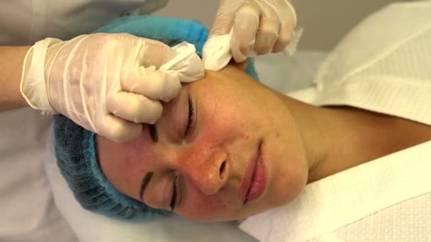 Limpeza facial mecânica — Vídeo de Stock