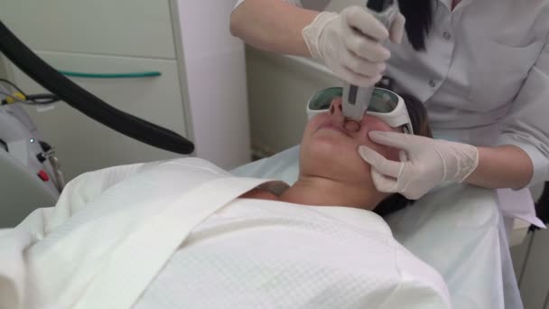 Άνω χείλος αποτρίχωση με laser από χέρια cosmetologist — Αρχείο Βίντεο