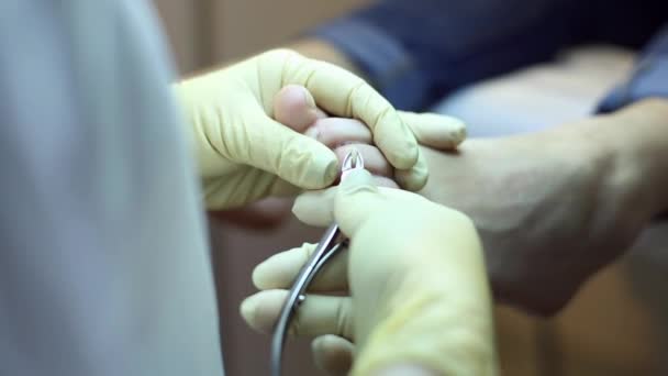 Pedicure stóp opieki usuwanie modzeli na palec — Wideo stockowe