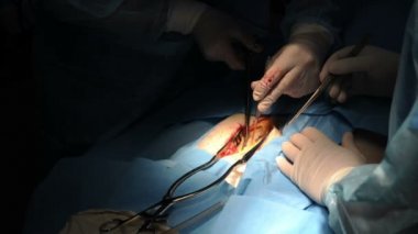 Cerrah onun bacak üzerinde bir işlem yapar