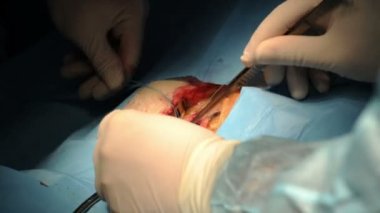 Doktor bacak üzerinde işlem yapar