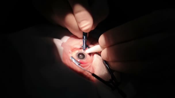 Chirurgické operace na oku člověka — Stock video