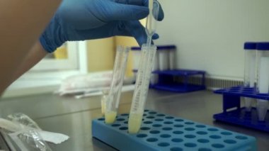 Doktor manipülasyon seminal sıvı sperm bağış yapar