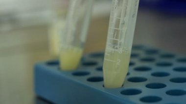 Doktor manipülasyon seminal sıvı sperm bağış yapar