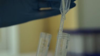 Doktor manipülasyon seminal sıvı sperm bağış yapar