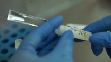 Doktor sperm donör sperm dondurma için hazırlar.