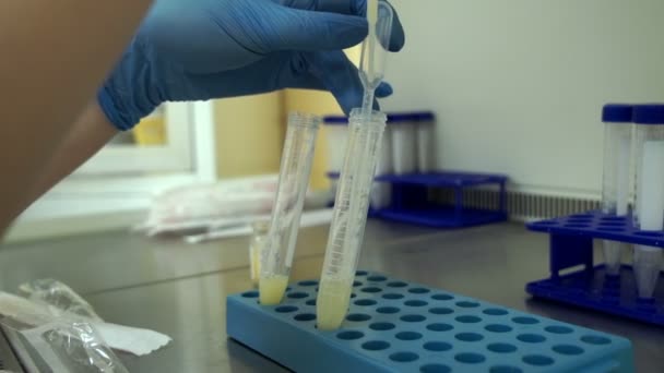 El médico lleva a cabo la manipulación de los donantes de esperma líquido seminal — Vídeos de Stock