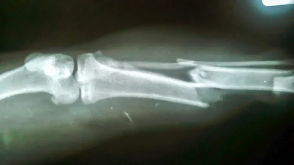 X-ray film, The cat was broken leg biting stray dogs — Stock Photo, Image