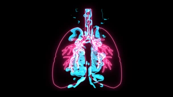 Edema pulmonar no pulmão digital holográfico, é um símbolo de asfixia que é muito perigoso — Vídeo de Stock