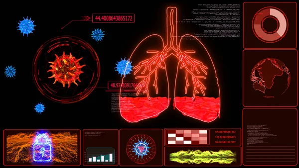 Futuristisk Monitorering Lungödem Ett Tillstånd Som Orsakas Onormal Vätska Alveolerna — Stockfoto