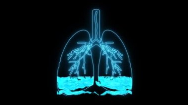 Akciğer ödemi, alveoldeki anormal sıvının neden olduğu bir durumdur. Oksijen yetersizliğinden nefes darlığı çeken hastalara neden olur.