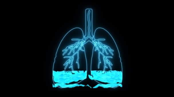 Edema polmonare è una condizione causata da liquido anormale negli alveoli. Risultato in pazienti con difficoltà respiratorie o mancanza di respiro a causa della mancanza di ossigeno — Video Stock