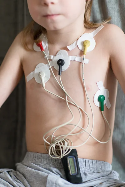 Cardiografía con Holter — Foto de Stock