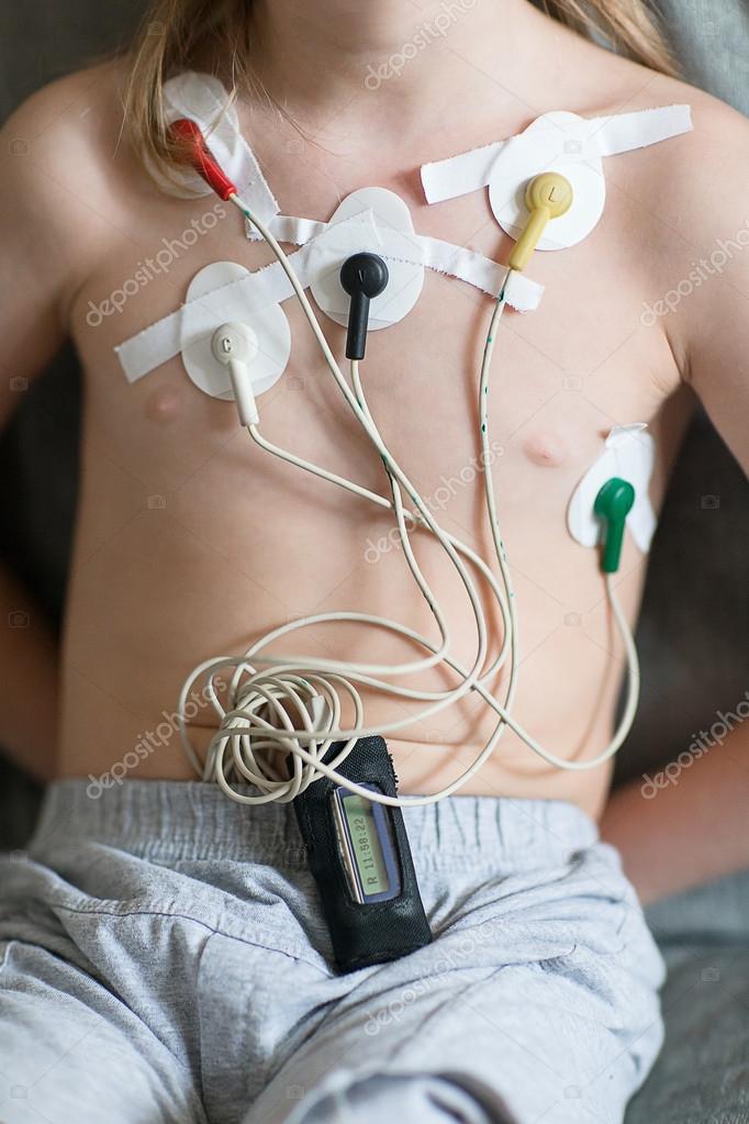 Heart cardiogram using Holter — Stock Photo © familylifestyle 108304706