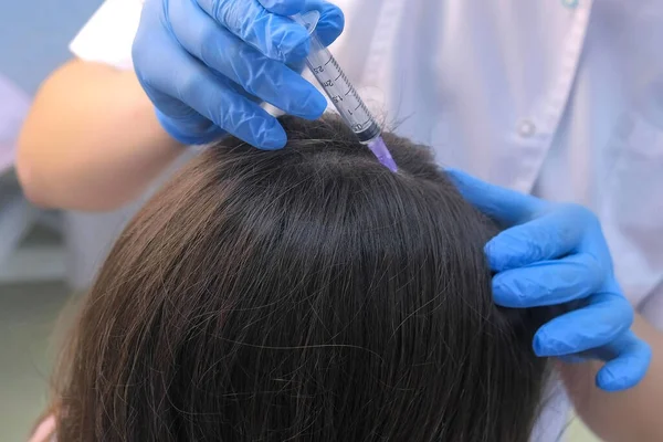 Doctor tricholoog het maken van injecties mesotherapie bij vrouw hoofdhuid, closeup view. — Stockfoto