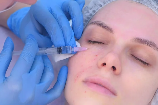 Cosmetologist que faz múltiplas injeções biorevitalization na pele de cara da mulher. — Fotografia de Stock