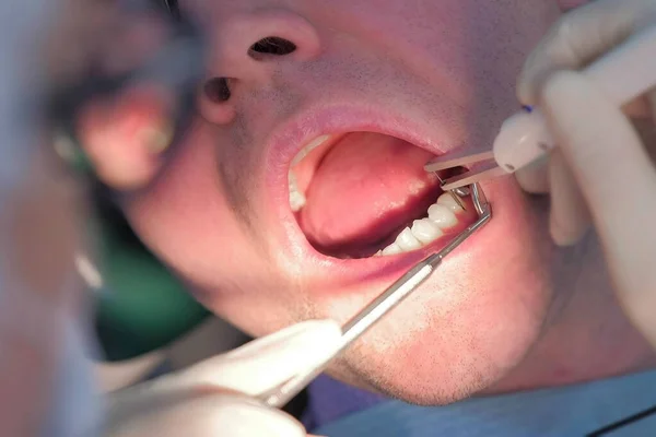 Dentista examinando las encías del paciente con sonda utilizando el método de diagnóstico por computadora. — Foto de Stock