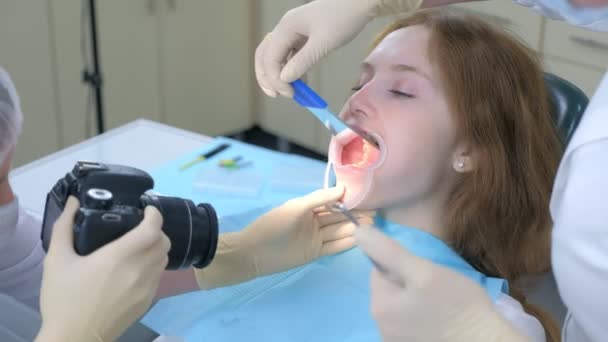 Tandarts orthodontist fotograferen met behulp van camera meisje tanden tonen in spiegel. — Stockvideo