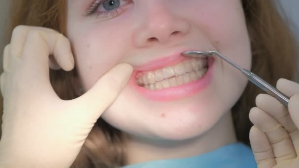 Ortodoncista mirando con espejo dental en frenos transparentes en los dientes de las niñas. — Vídeo de stock