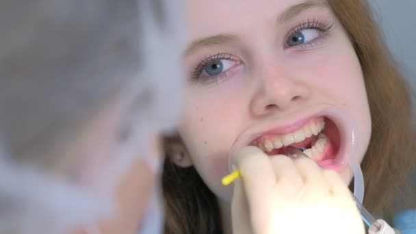 Ortodoncista cubriendo gel especial en dientes de mujer en odontología usando cepillo. — Vídeo de stock