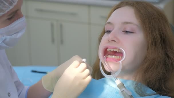 Orthodontist veegt vrouwen tanden in de tandheelkunde voor beugels installeren. — Stockvideo