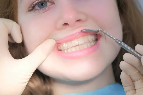 Orthodontiste regardant avec miroir dentaire sur orthèses transparentes sur les dents des filles. — Photo