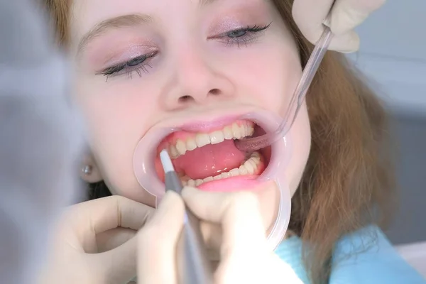 Patiente femme sur la procédure hygiénique de nettoyage des dents en dentisterie par le dentiste. — Photo