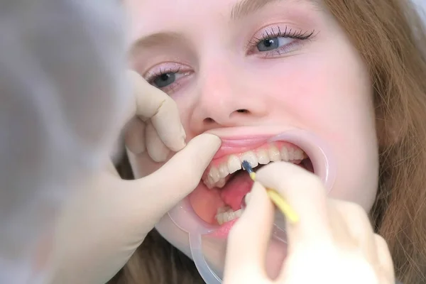Orthodontiste couvrant gel spécial sur les dents de femme en dentisterie à l'aide d'une brosse. — Photo
