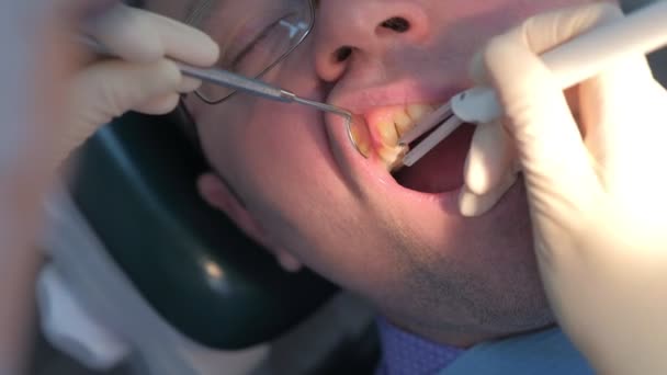 Dentista examinando gengivas de paciente com sonda usando método de diagnóstico de computador. — Vídeo de Stock
