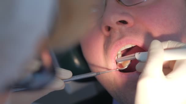 Tandläkare undersöka patientens tandkött med sond med hjälp av metoden för datordiagnostik. — Stockvideo