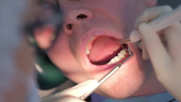 Tandläkare undersöka patientens tandkött med sond med hjälp av metoden för datordiagnostik. — Stockvideo
