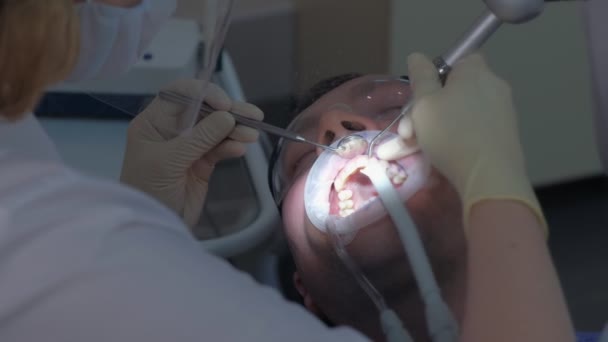 Paciente hombre en procedimiento de limpieza de dientes ultrasónicos en odontología por dentista. — Vídeo de stock