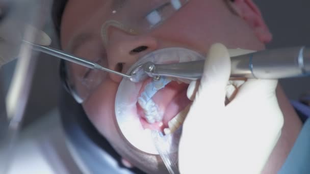 Stomatologist is cleaning mans teeth using electric toothbrush in dentistry. — Stock Video