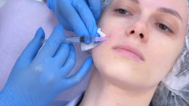 Косметолог робить декілька ін'єкцій шкіри обличчя жінки під час мезотерапії . — стокове відео