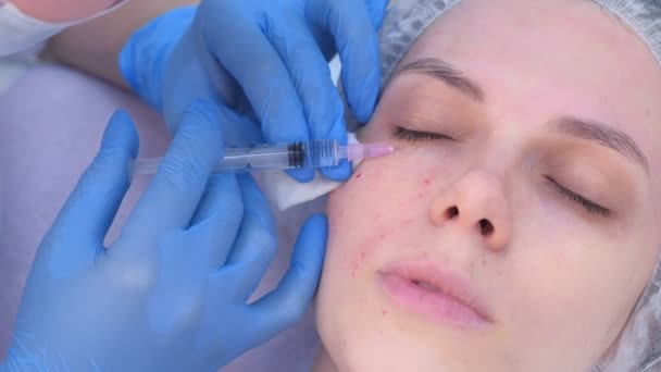 Cosmetoloog het maken van meerdere injecties biorevitalisatie in vrouw gezicht huid. — Stockvideo