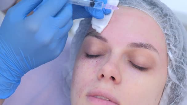 Cosmetoloog maakt meerdere injecties biorevitalisatie in meisje voorhoofd huid. — Stockvideo