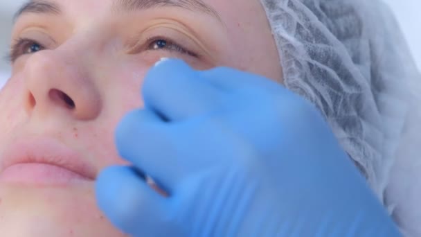 Kosmetologe macht mehrere Injektionen Biorevitalisierung in weibliche Gesichtshaut. — Stockvideo