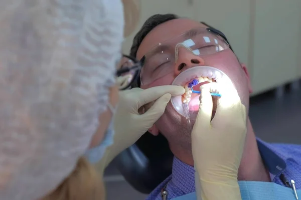 El dentista está aplicando gel azul en los dientes de los hombres para encontrar sarro dental y caries. — Foto de Stock